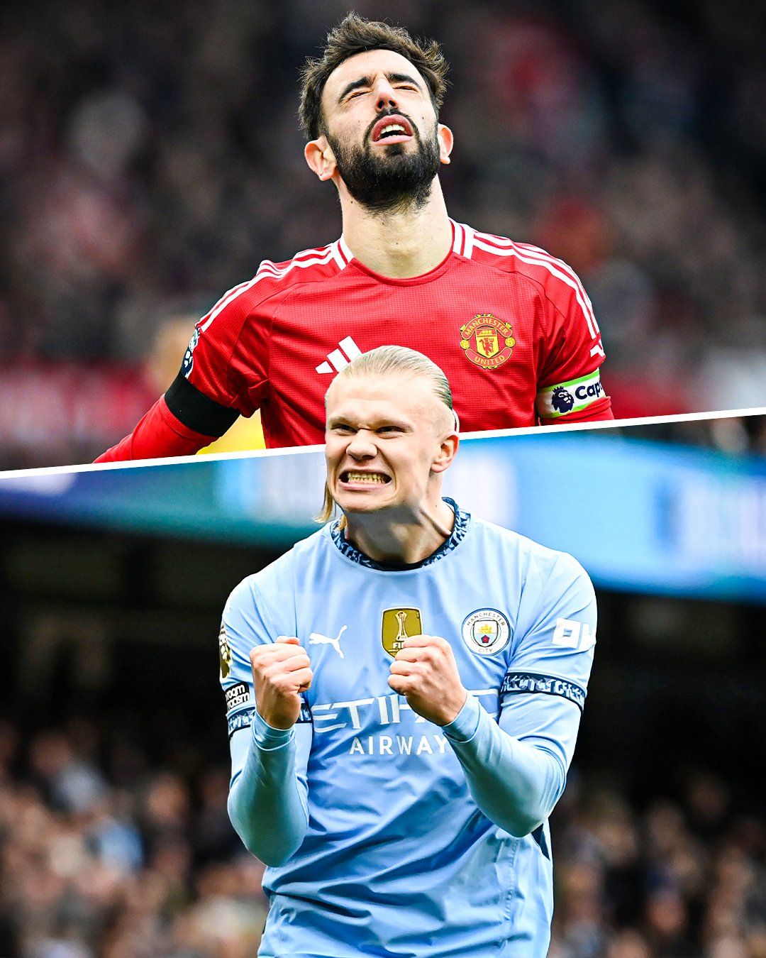 City United derby injuries